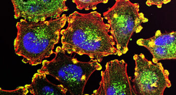 First coding and now cancer, AI is transforming the healthcare industry